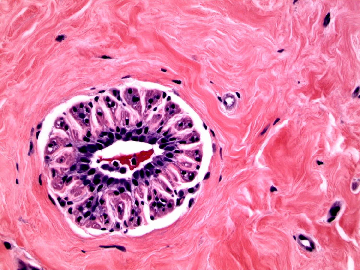 myoid atrophy.jpg