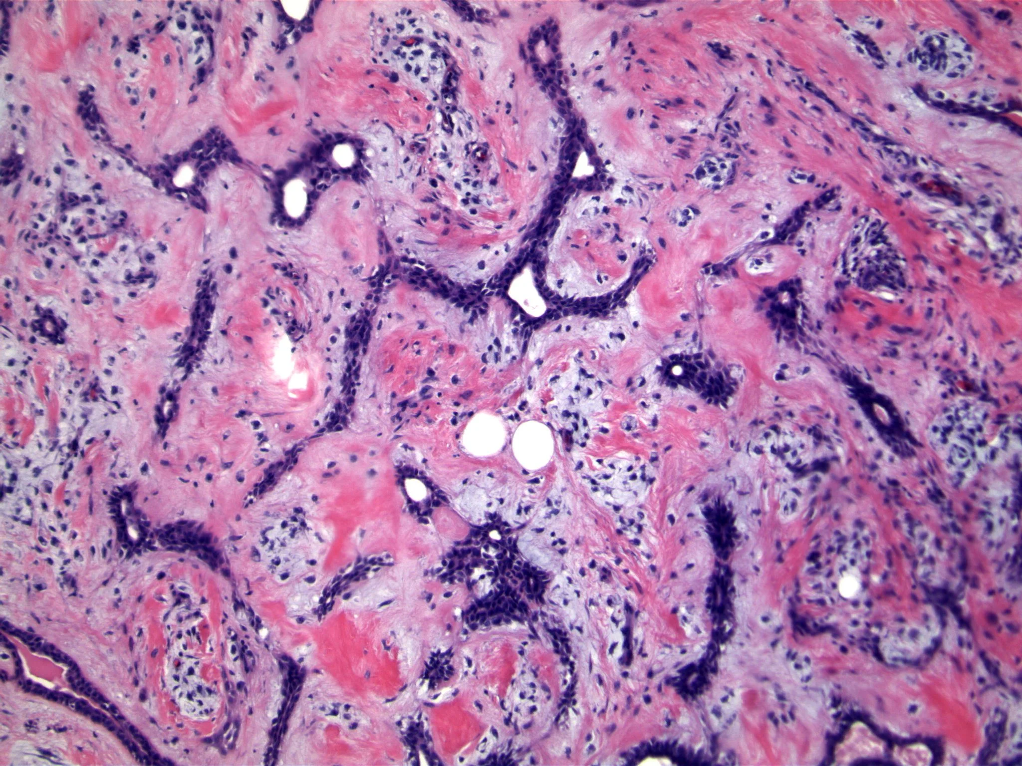 Image 3: As indicated for Image 2.