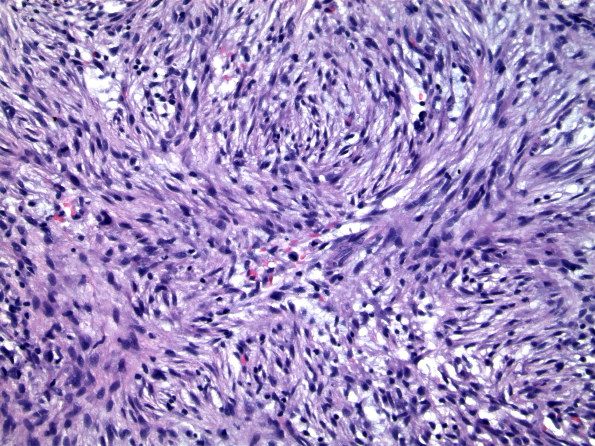 Image 4. Occasional mitotic figures are present (center of field).