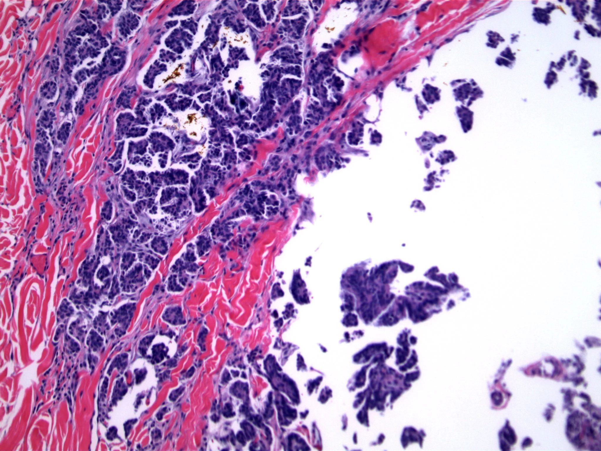 Image 2. The cellular clusters are present in ‘empty’ spaces.. 