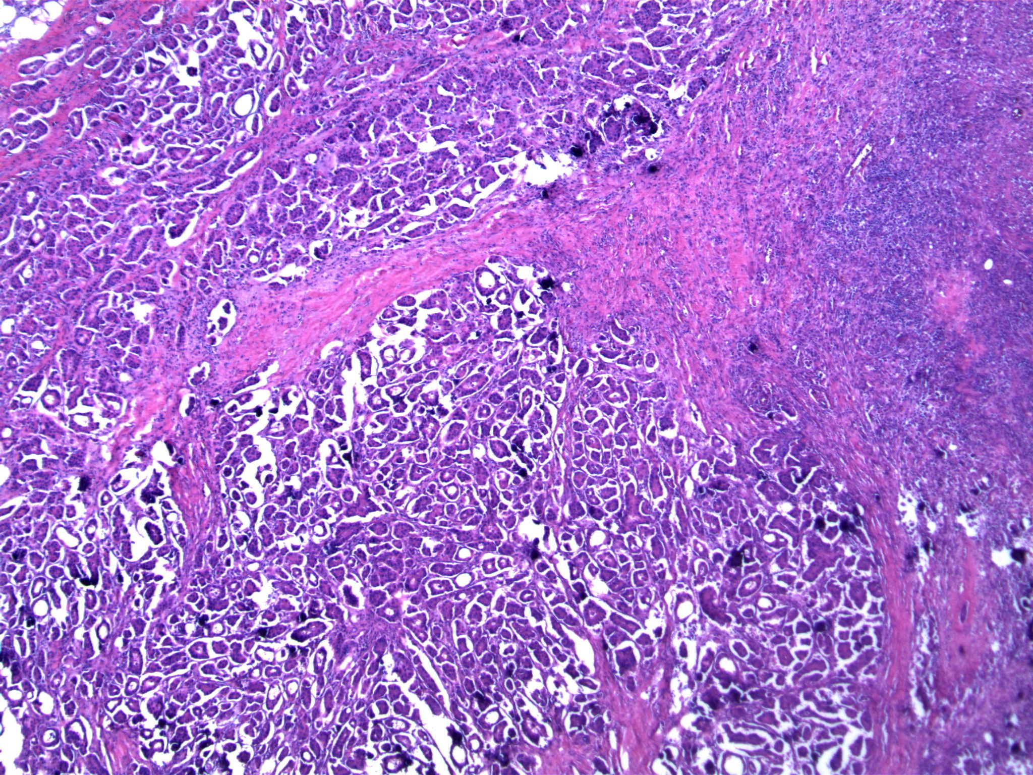 Image 6. Numerous cellular clusters are present in ‘empty’ spaces.