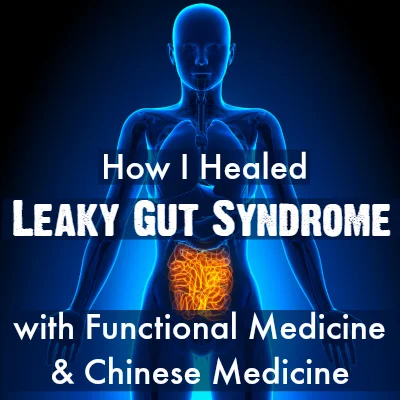 How I Healed Leaky Gut Syndrome with Functional Medicine and Chinese Medicine
