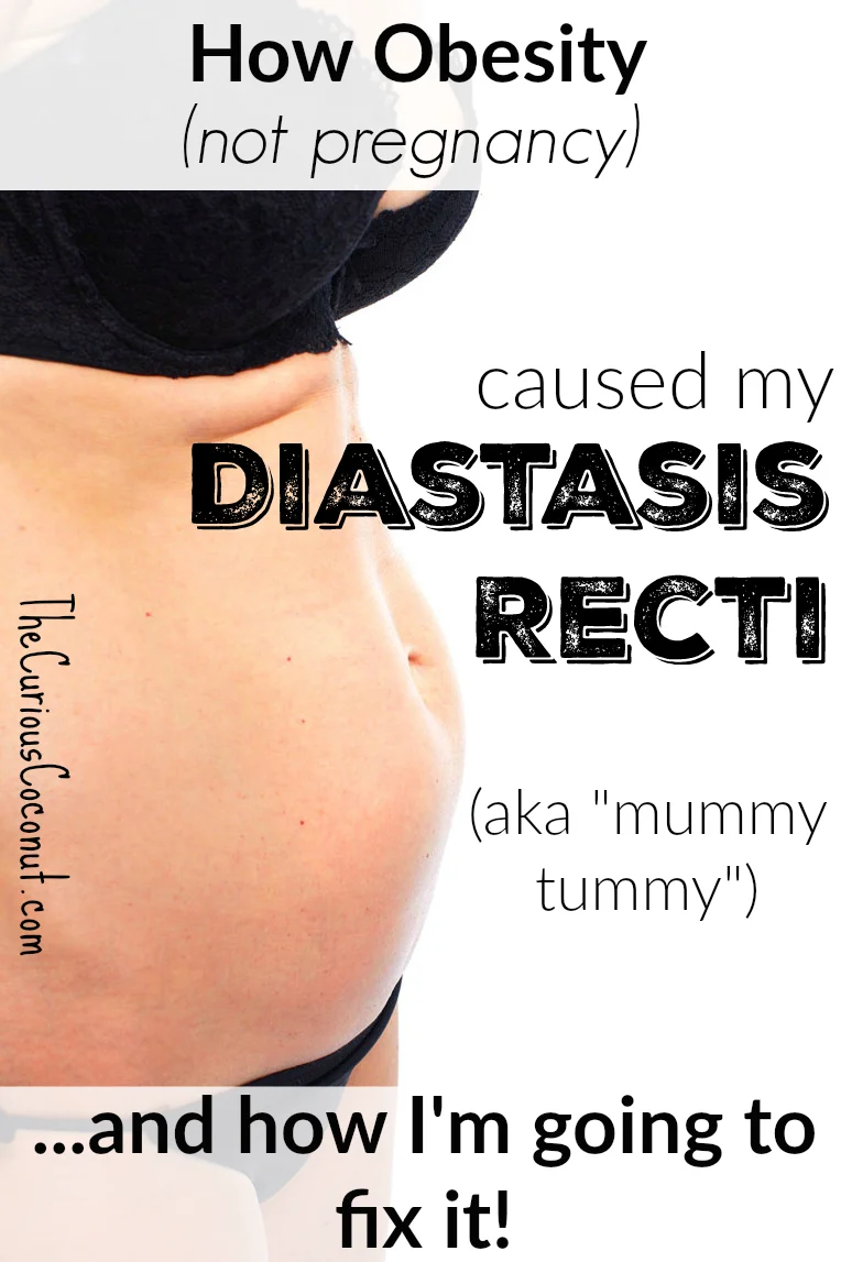 Visceral Fat and Diastasis Recti - StrengthSpace