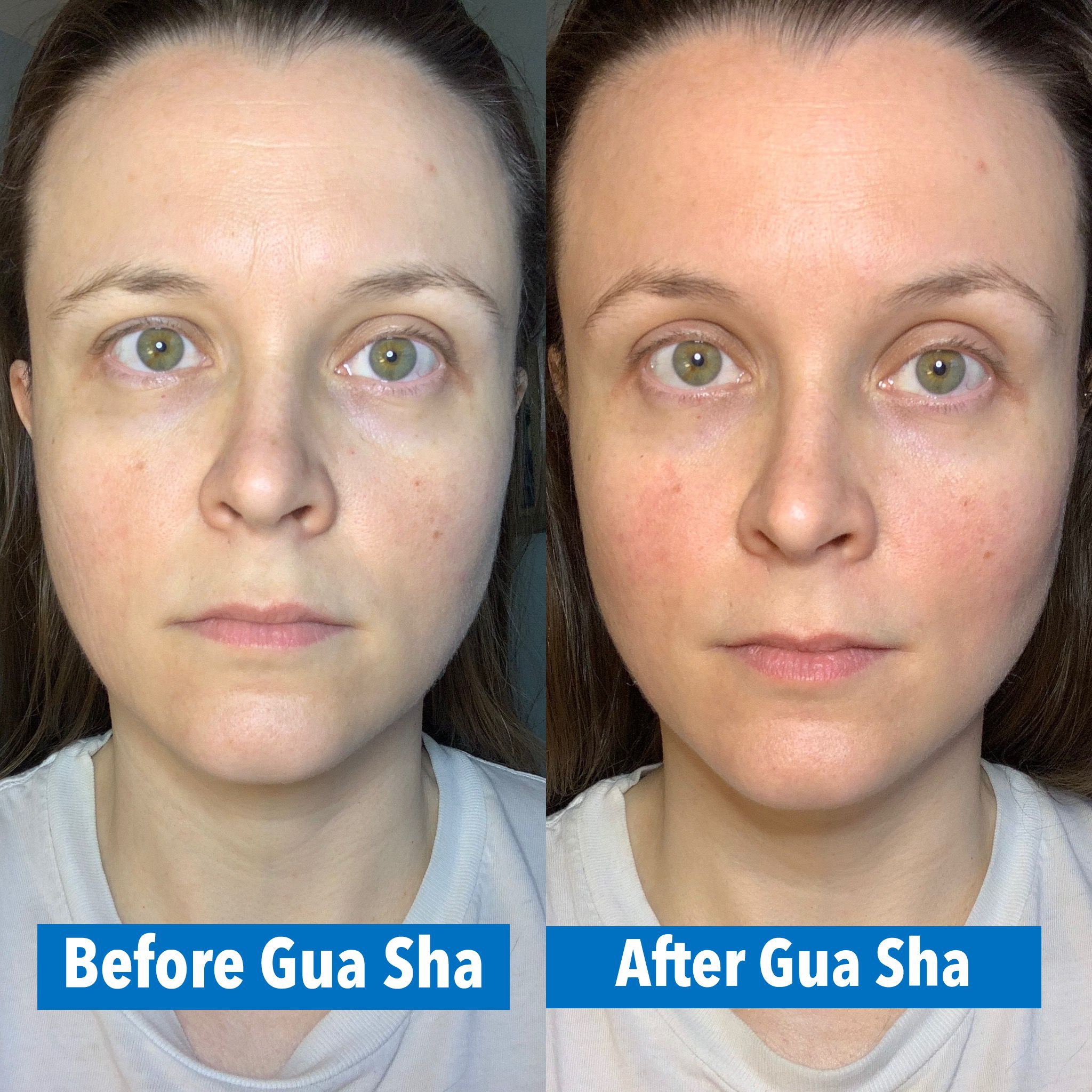 Gua sha: Uses, benefits, and side effects