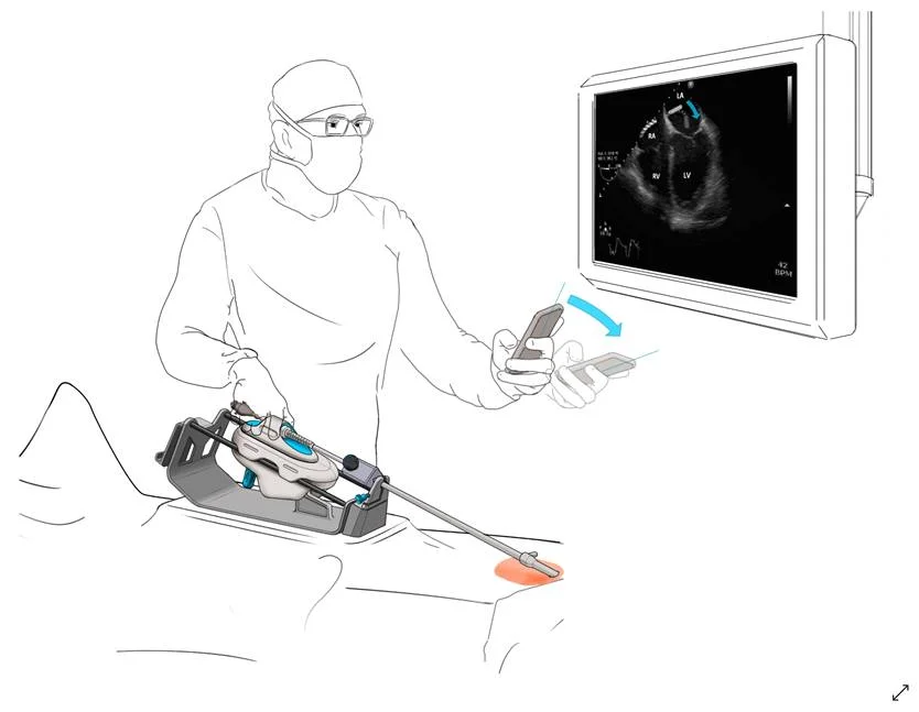 Project Moray Medical Device Industrial Design Sketch
