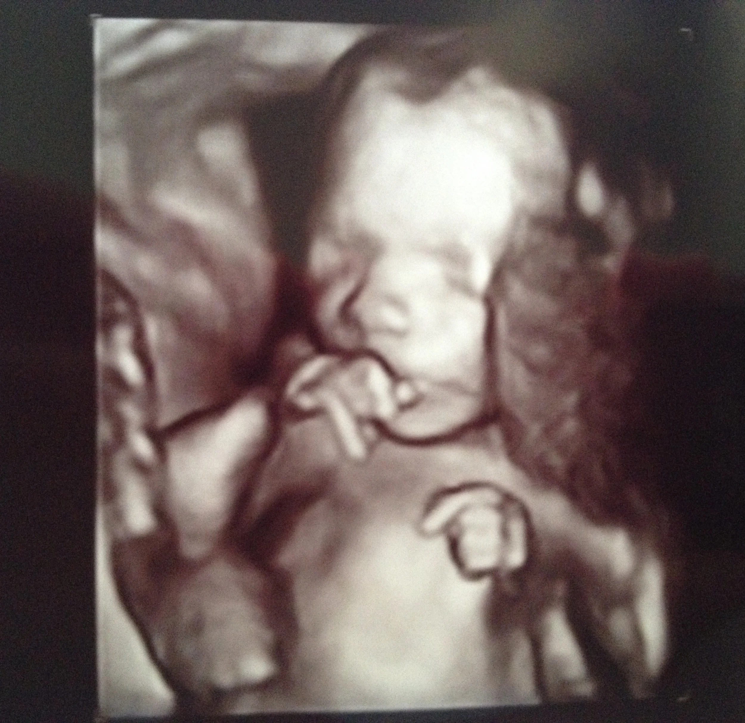 Austin at 20 weeks