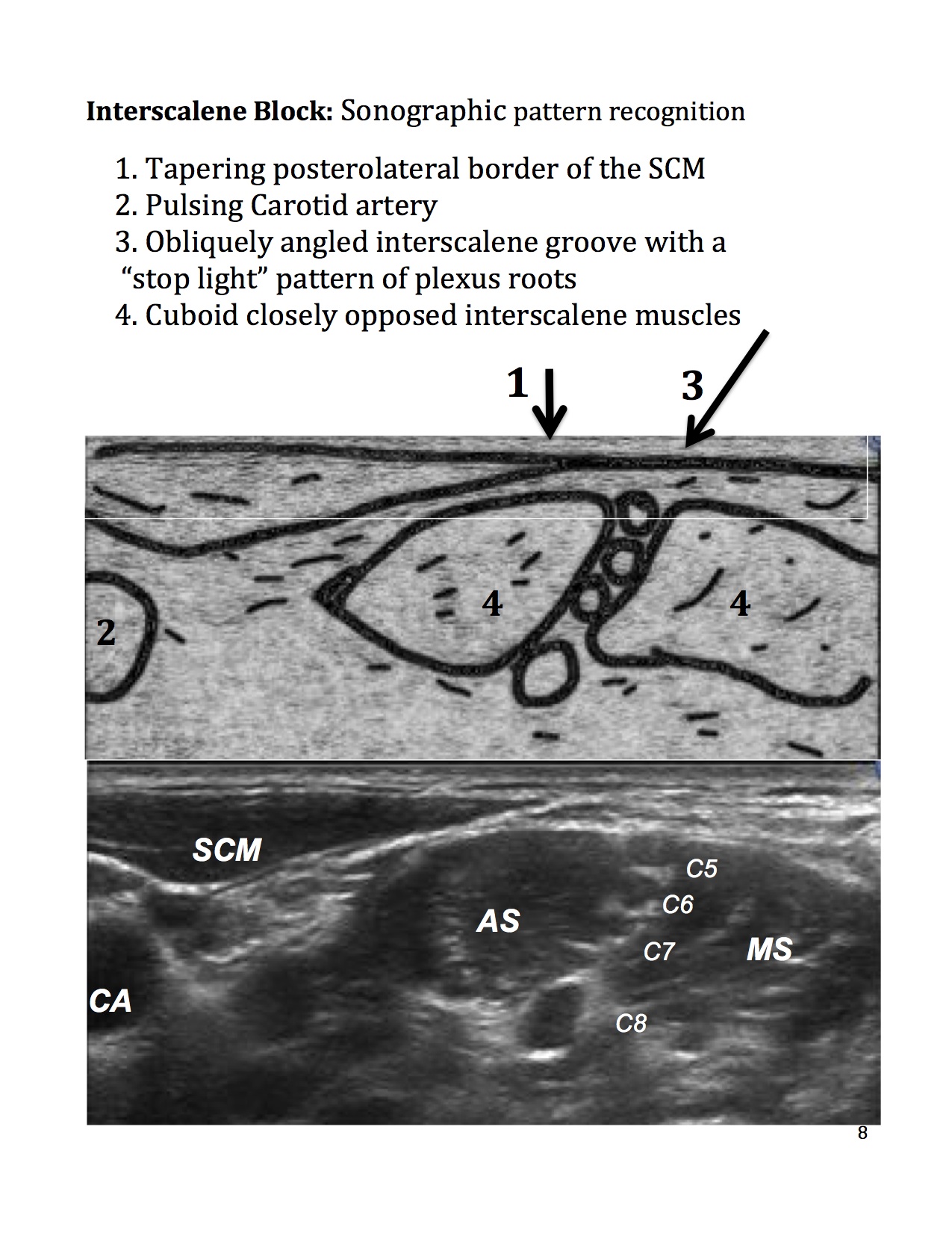 8_Insterscalene.workbook.jpg