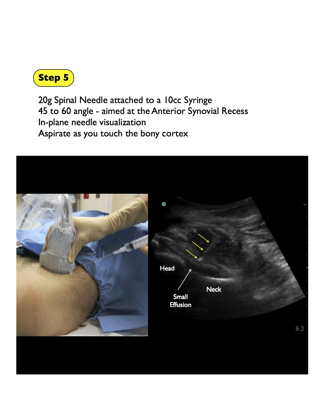 hip artrocentesis basic_5.jpg