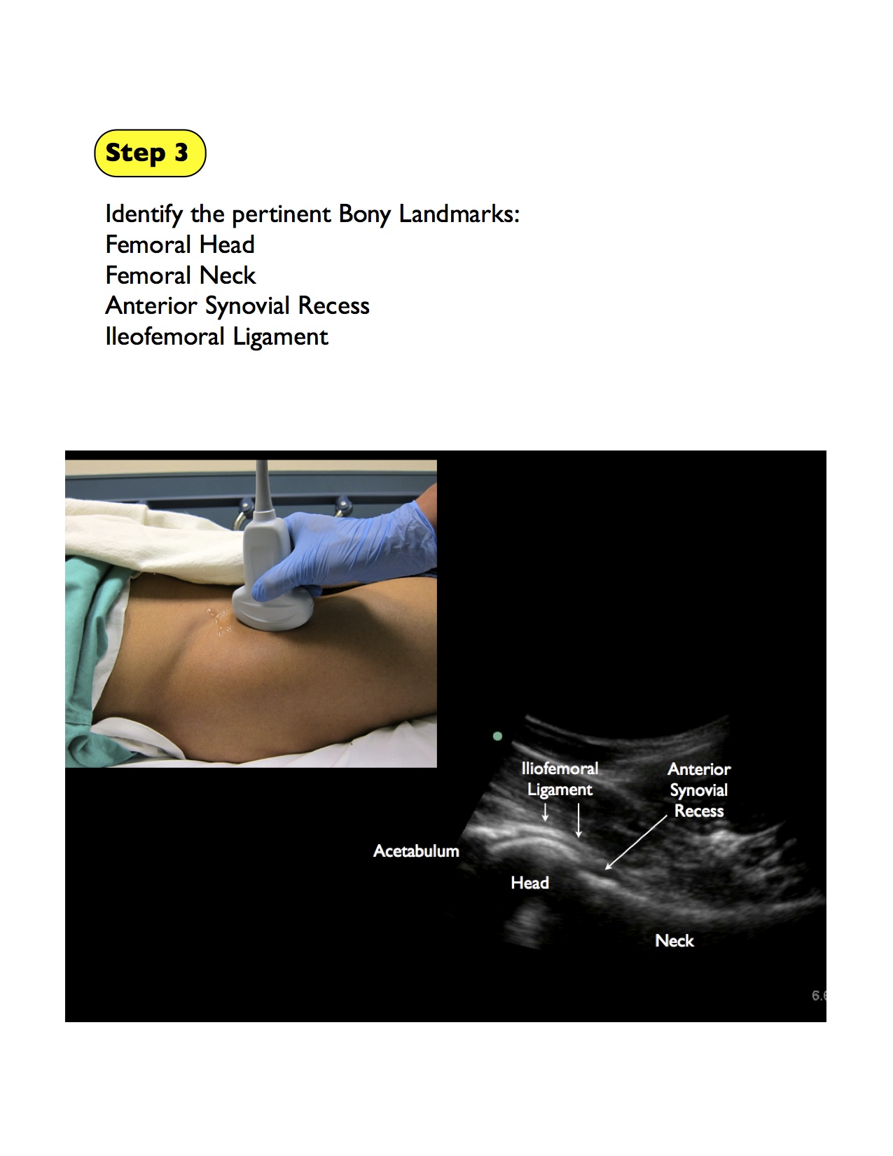 hip artrocentesis basic_3.jpg