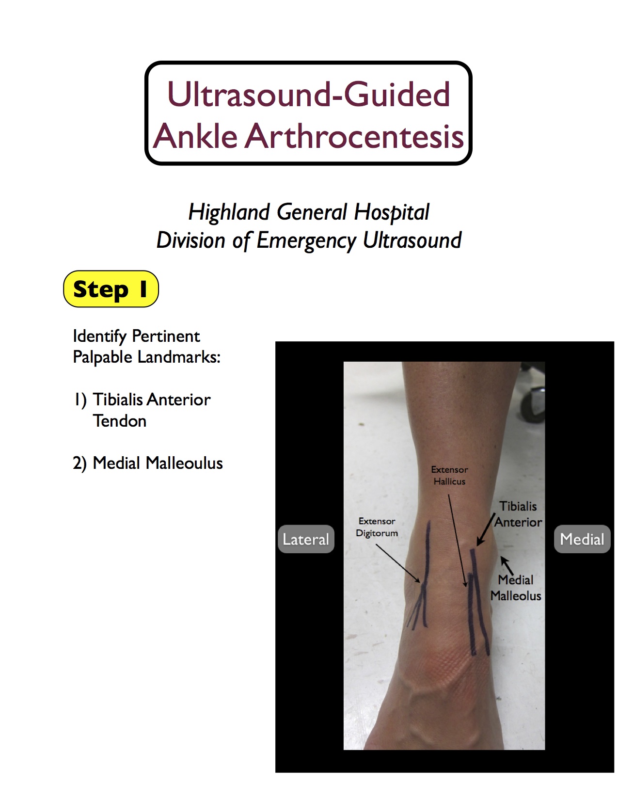 1 ankle arthrocentesis final.jpg