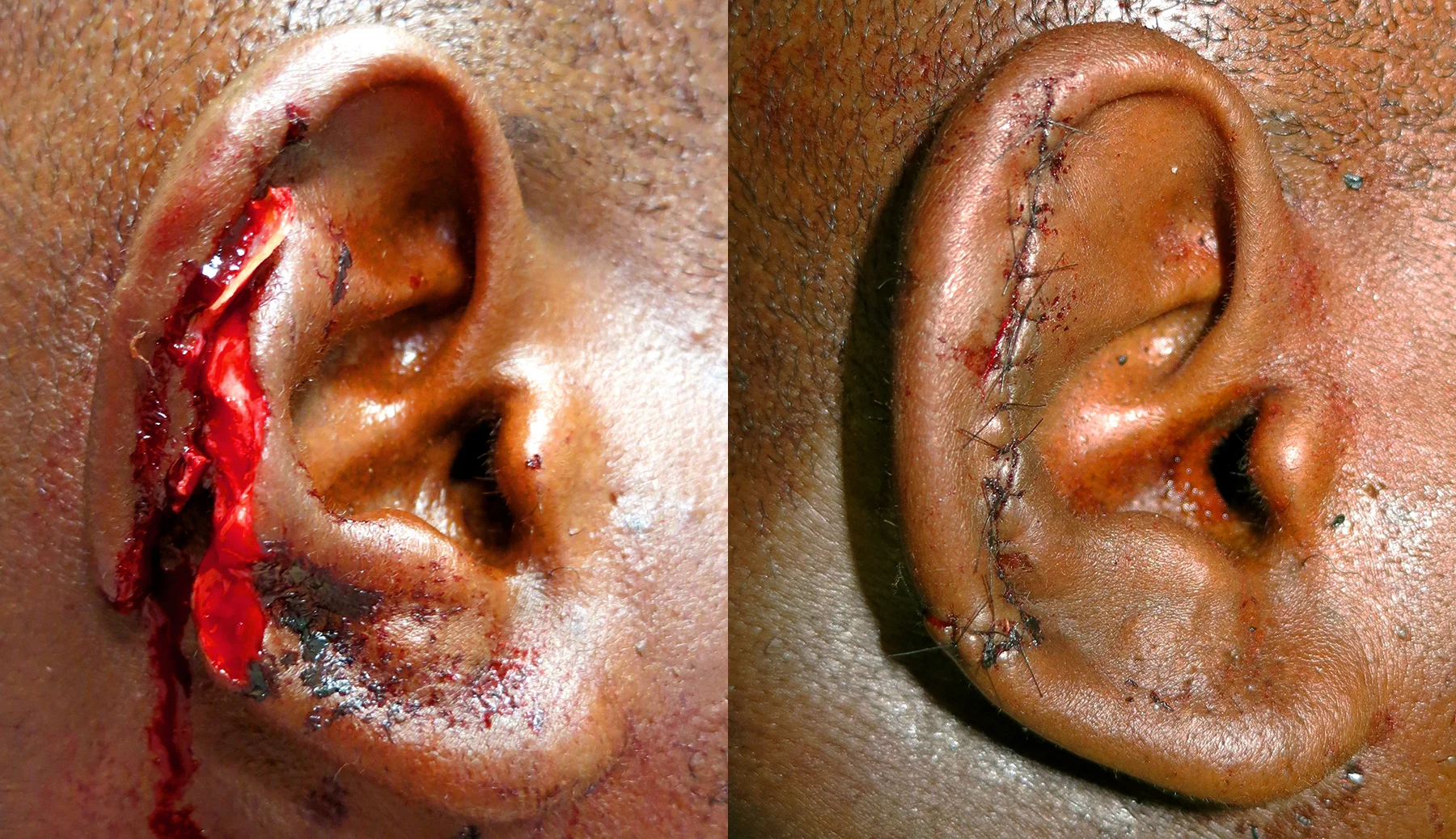 ear before after.jpg