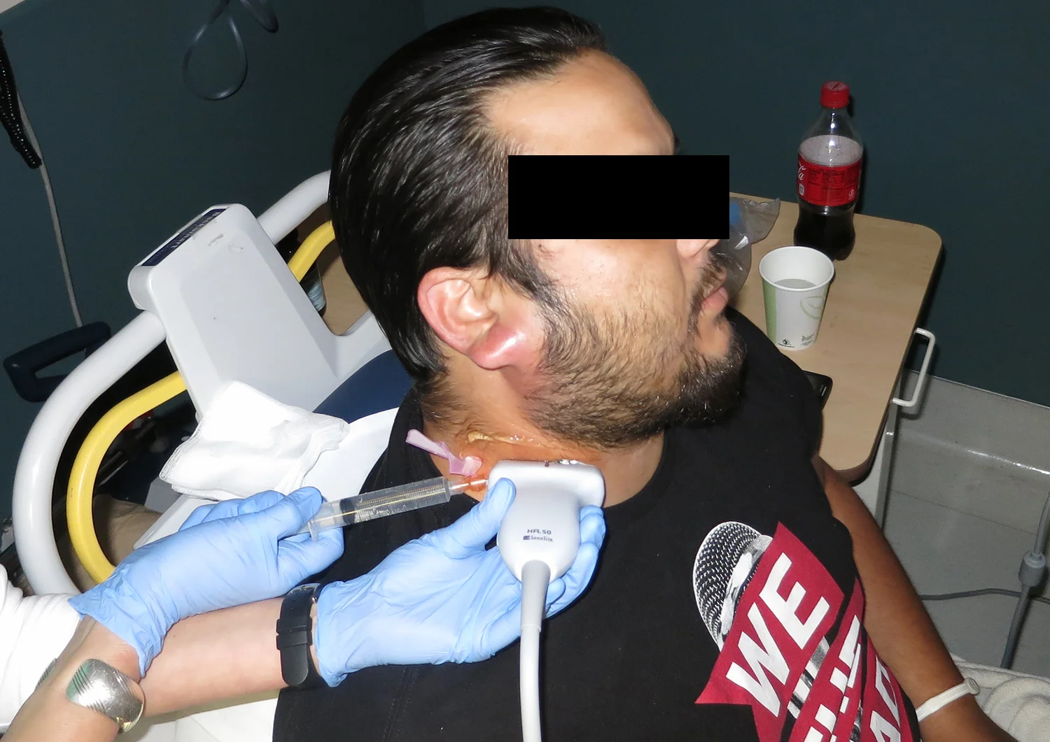 ear abscess copy.jpg