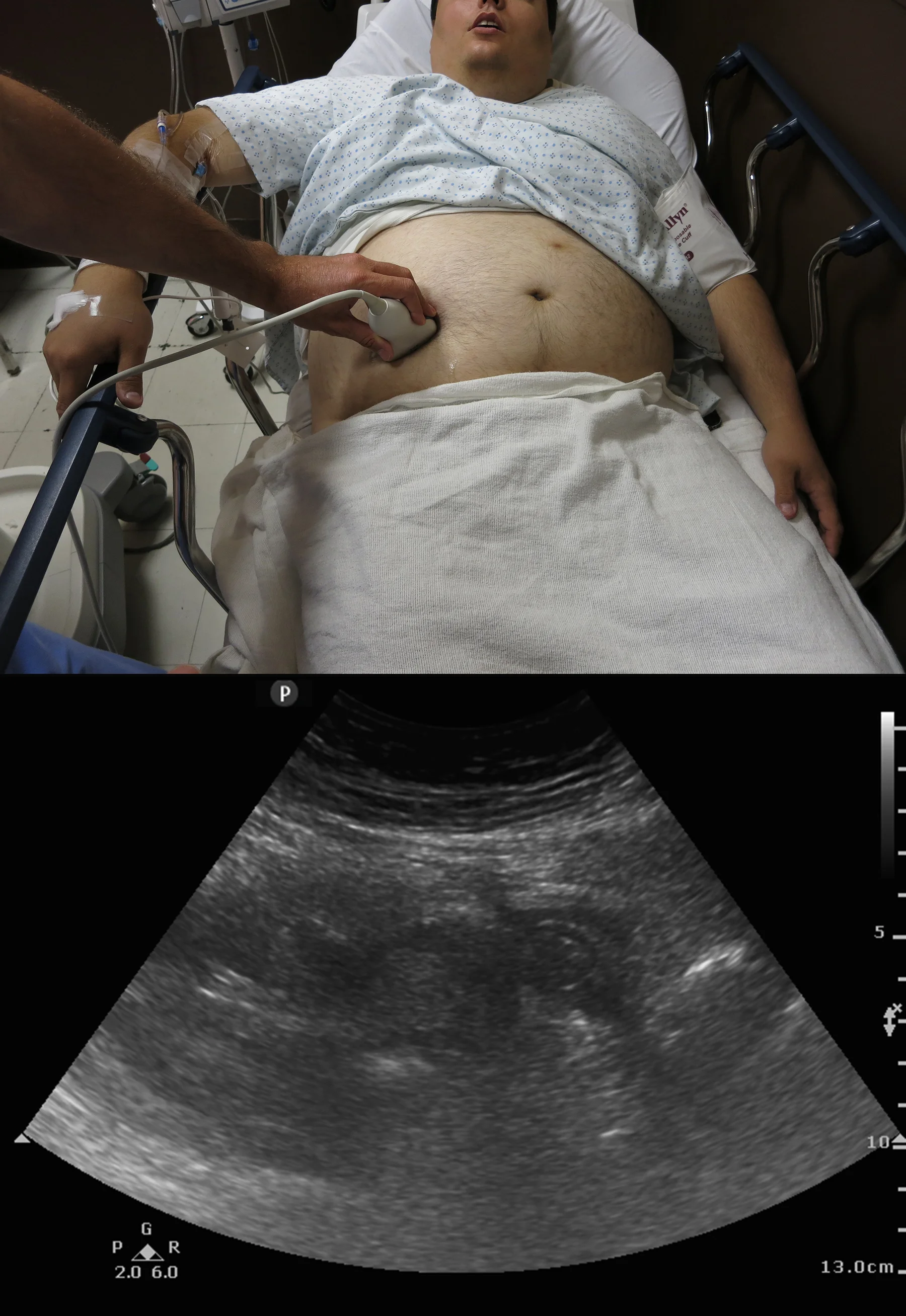 Big BMI appy scan .jpg