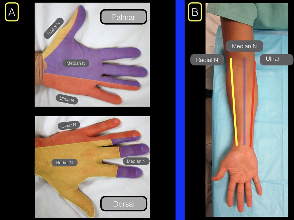 Forearm blocks — Highland EM Ultrasound Fueled pain management