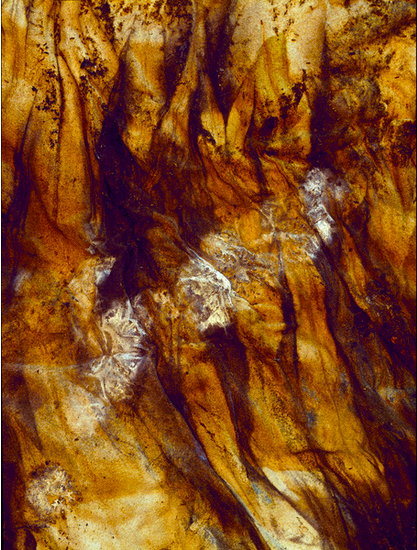 Heart Attack, Female, 60 years old, 2010 Archival pigment print 40 x 30 inches