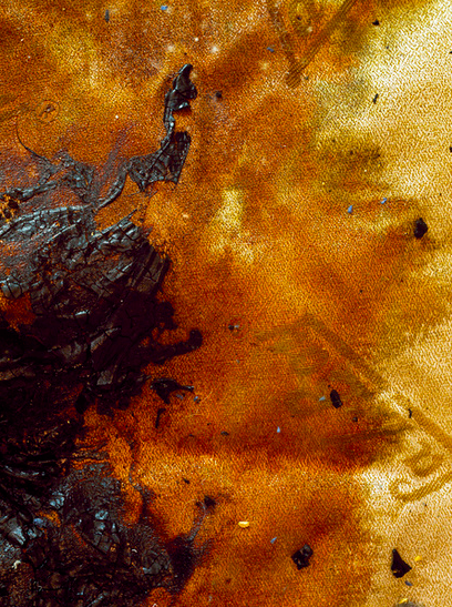 Heart Attack, Male, 50 years old (I), 2010 Archival Pigment Print 40 x 30 inches
