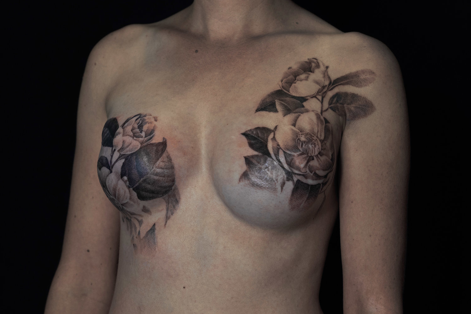 Mastectomy — David Allen Mastectomy — David Allen