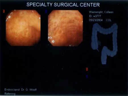cscope0904.jpg