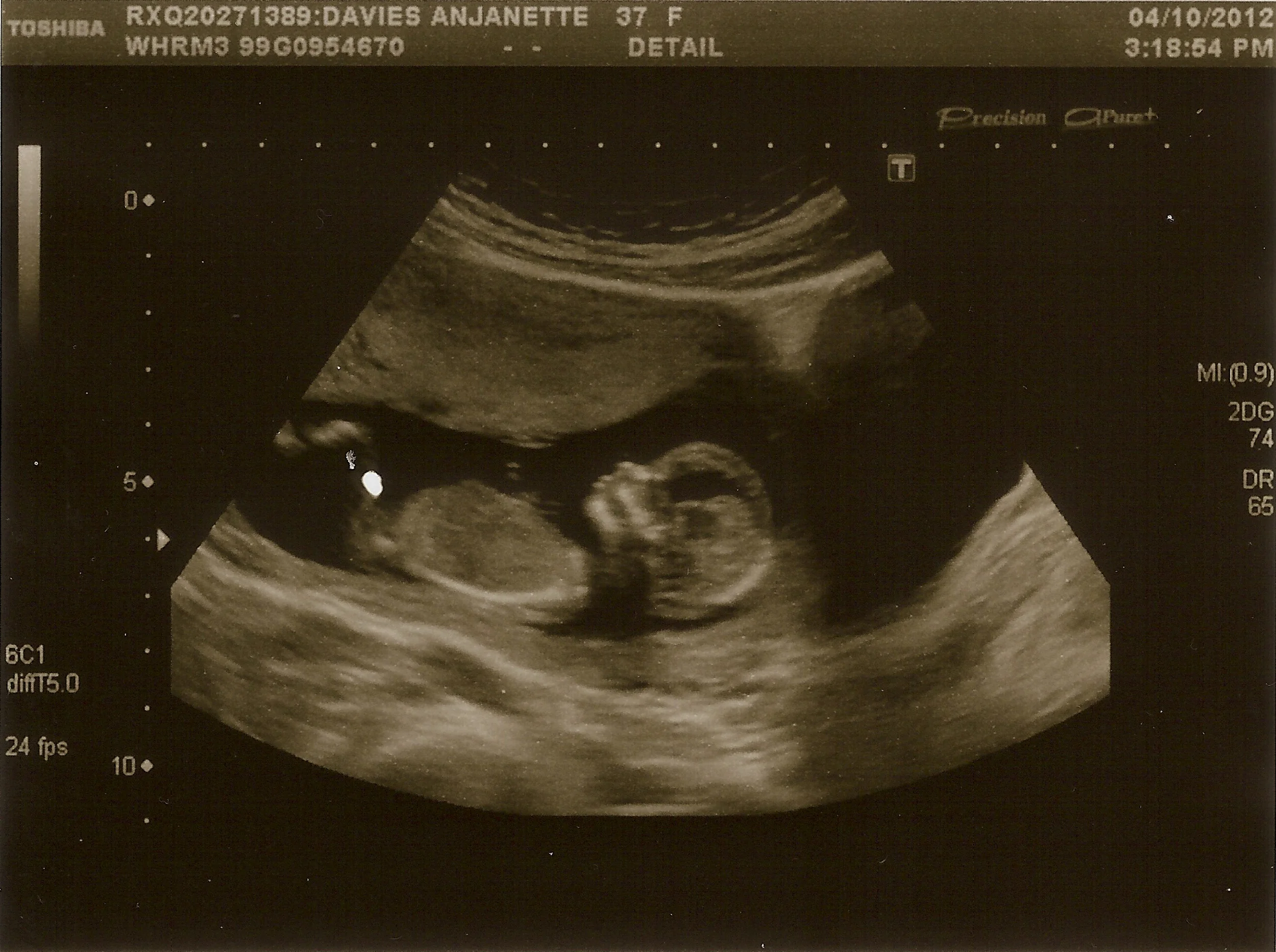 Baby Davies 6 - 4th October 2012.jpg