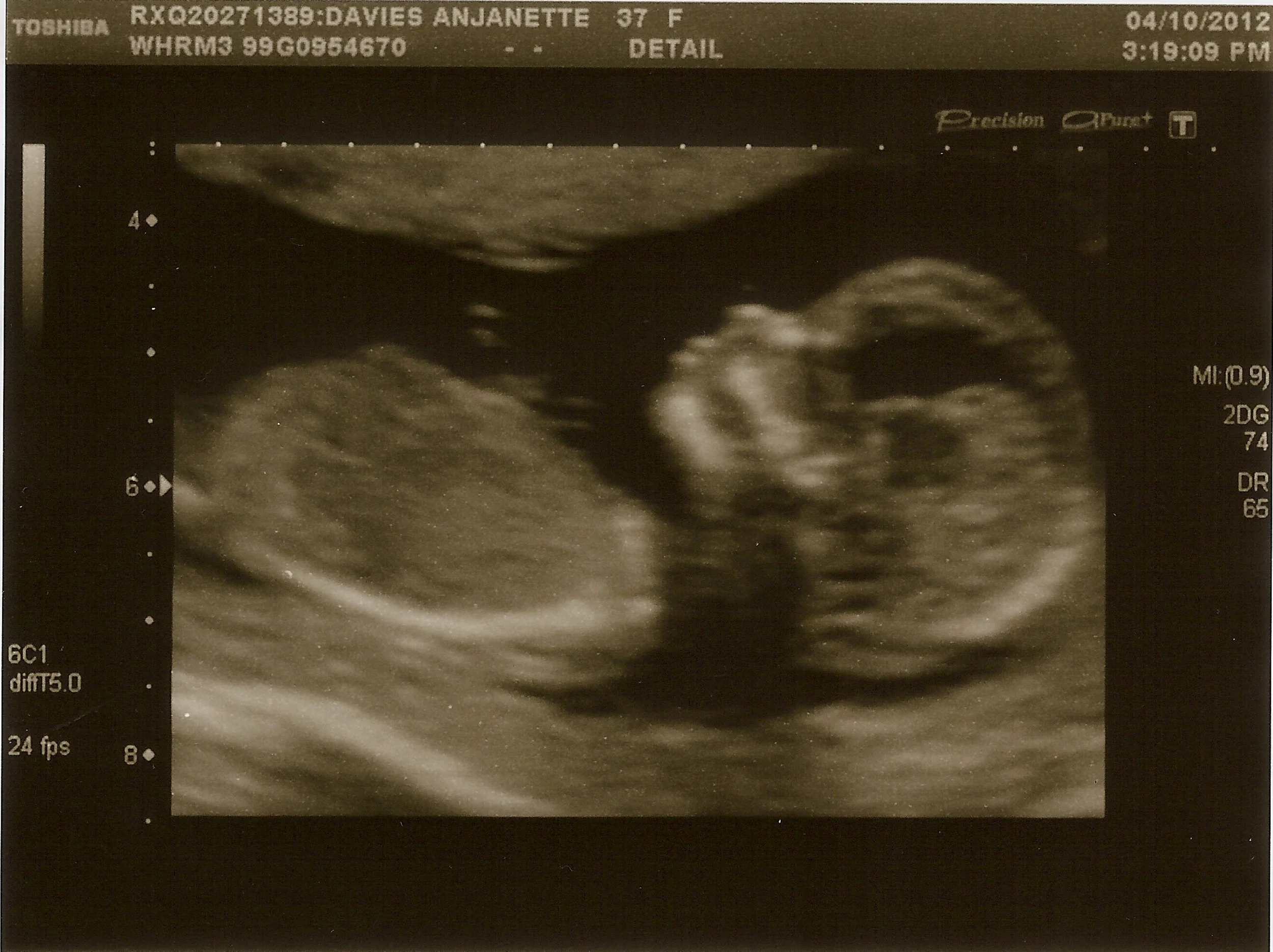Baby Davies 1 - 4th October 2012.jpg