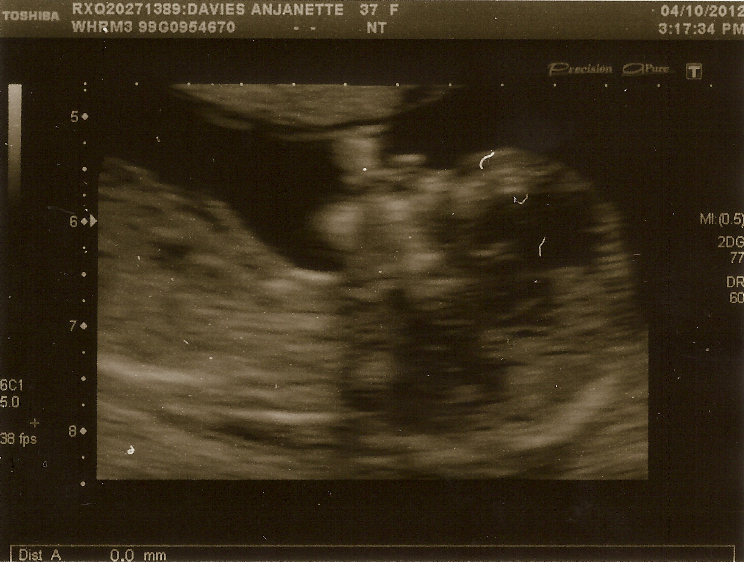 Baby Davies 7 - 4th October 2012.jpg