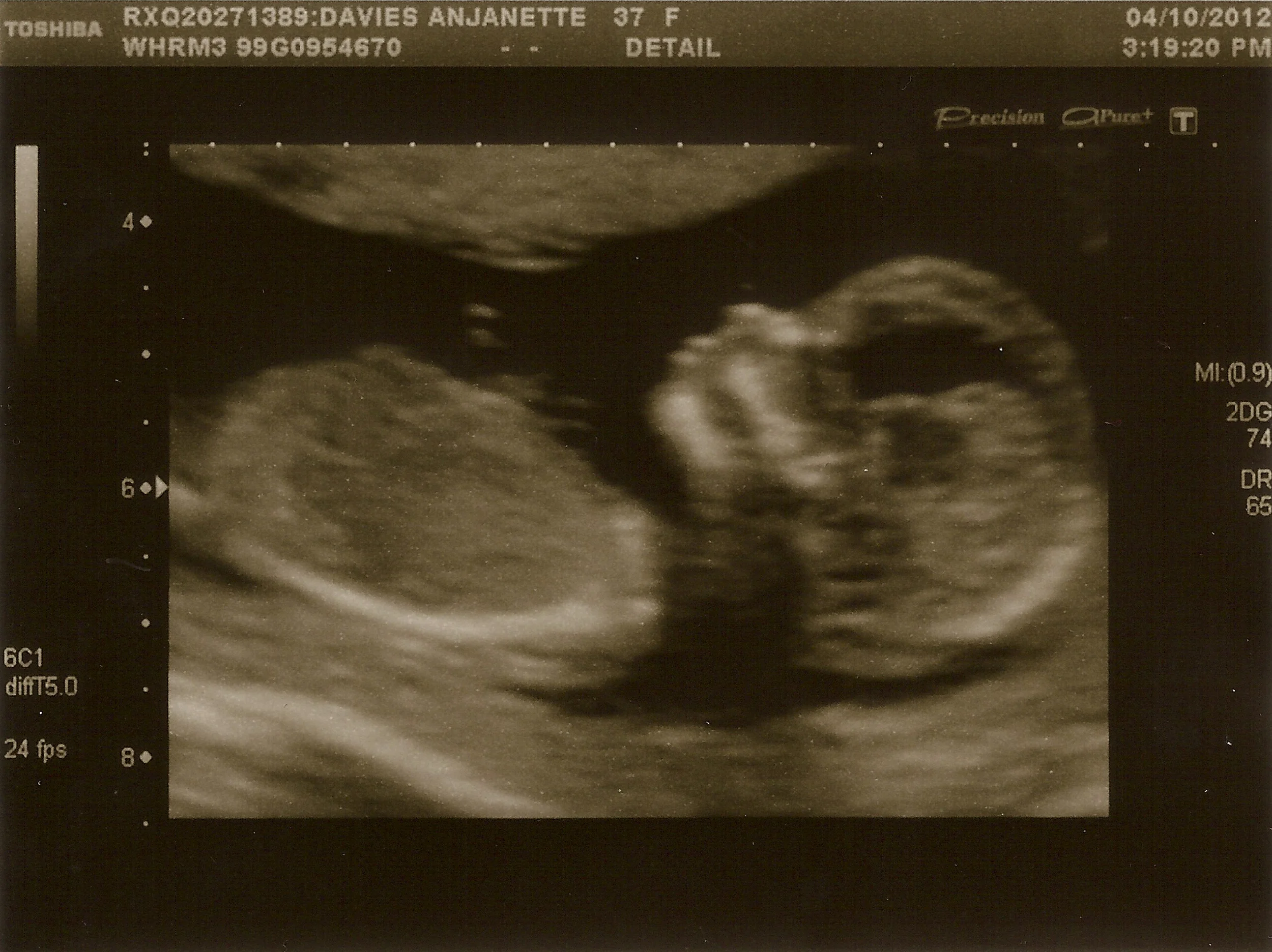 Baby Davies 3 - 4th October 2012.jpg