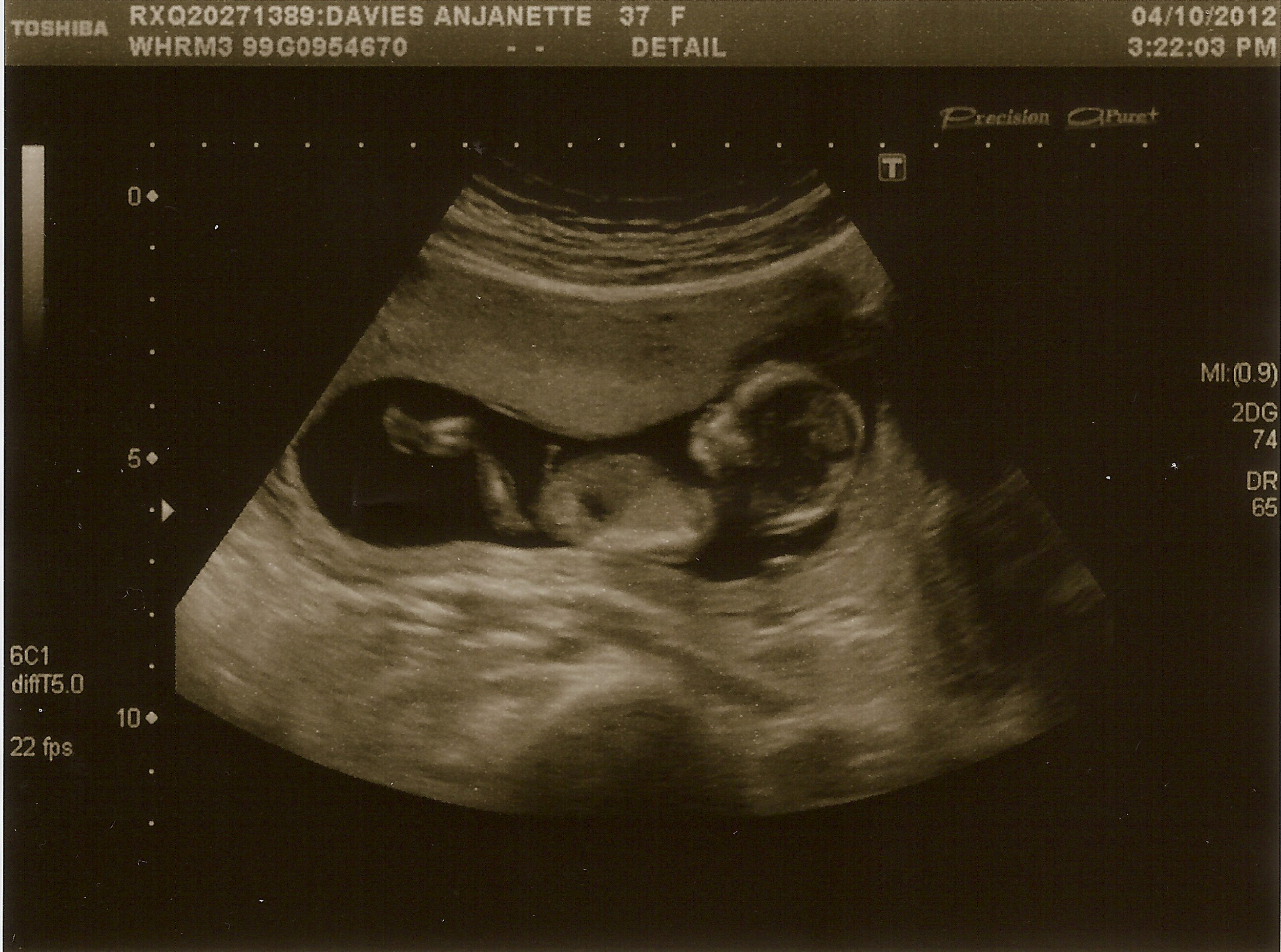 Baby Davies 2 - 4th October 2012.jpg
