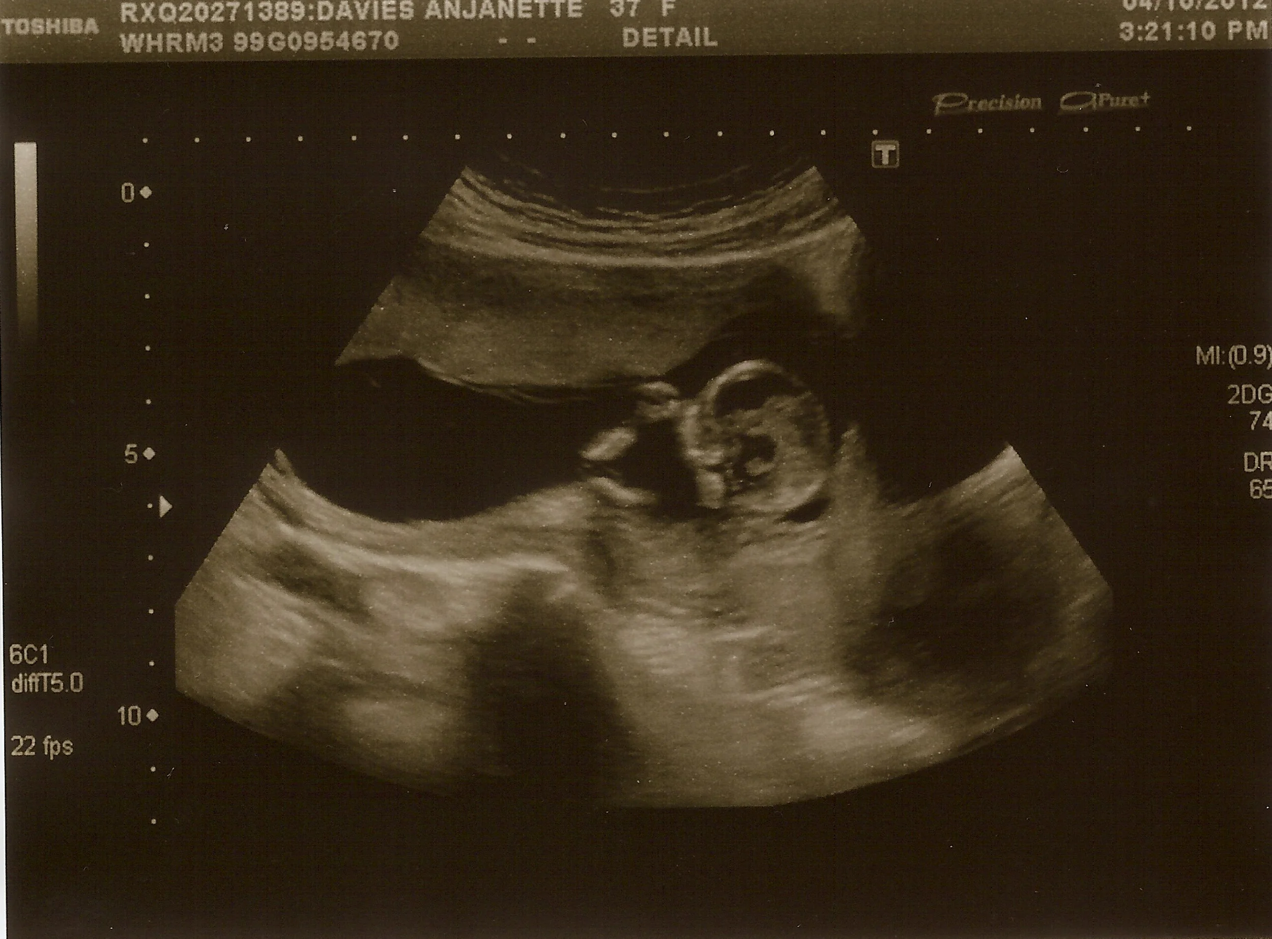 Baby Davies 4 - 4th October 2012.jpg
