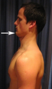 Packing the neck - terrible for selfies, great for deadlifts.