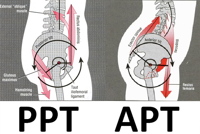 We call this picture
