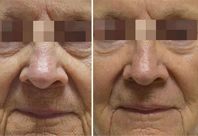 Fractora 3.jpg
