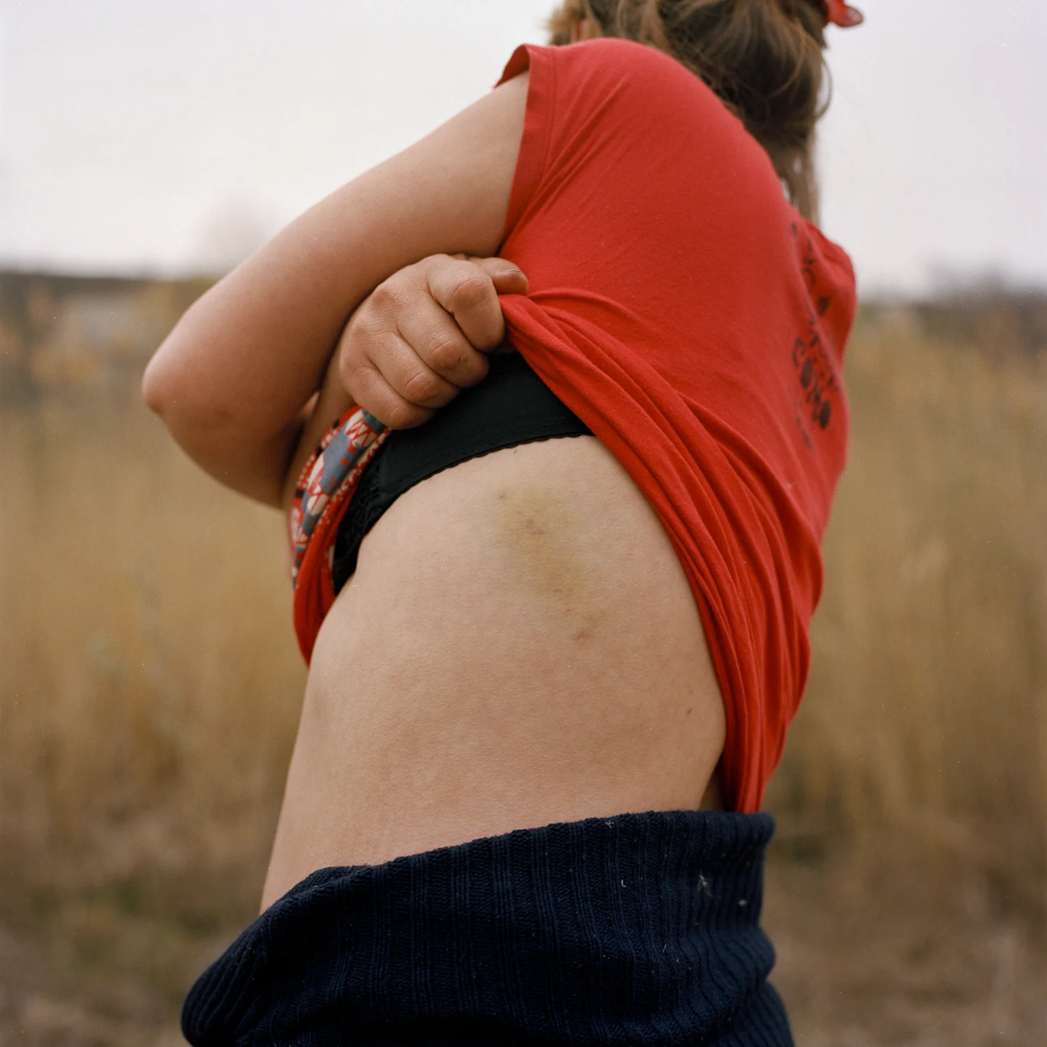 Andrea reveals a
bruise that her ill-tempered husband had recently left on her. Two years prior, she left for Turkey to provide for her family of three young children, and
was locked up by traffickers in an apart- ment which she eventually escaped. She
is now back with her abusive partner in her native Moldova, making ends meet.
0
false
18 pt
18 pt
0
0
false
false
false
/* Style Definitions */
table.MsoNormalTable
{mso-style-name:"Table Normal";
mso-tstyle-rowband-size:0;
mso-tstyle-colband-size:0;
mso-style-noshow:yes;
mso-style-parent:"";
mso-padding-alt:0cm 5.4pt 0cm 5.4pt;
mso-para-margin-top:0cm;
mso-para-margin-right:0cm;
mso-para-margin-bottom:10.0pt;
mso-para-margin-left:0cm;
line-height:115%;
mso-pagination:widow-orphan;
font-size:12.0pt;
font-family:"Times New Roman";
mso-ascii-font-family:Calibri;
mso-ascii-theme-font:minor-latin;
mso-fareast-font-family:"Times New Roman";
mso-fareast-theme-font:minor-fareast;
mso-hansi-font-family:Calibri;
mso-hansi-theme-font:minor-latin;}