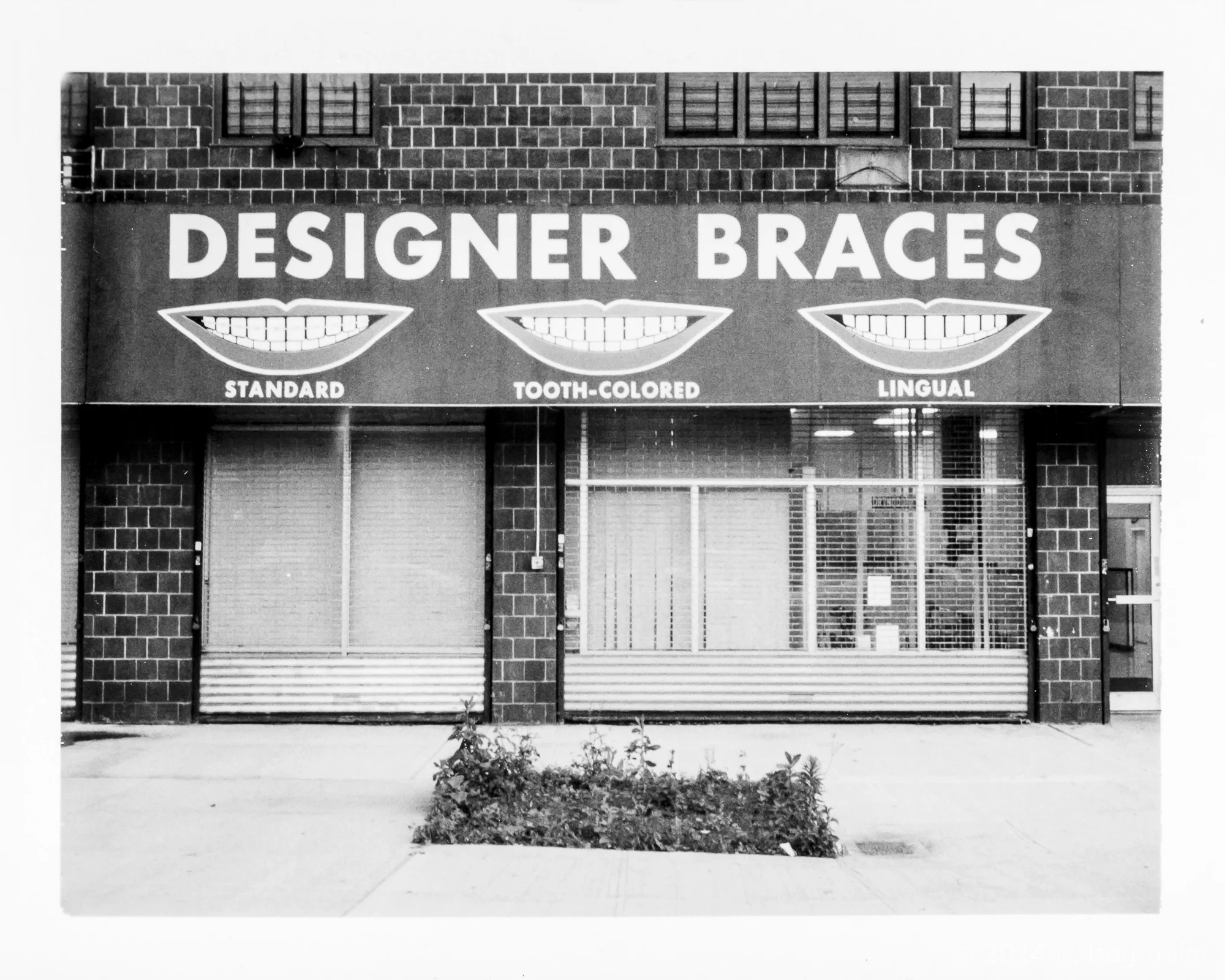 20140701_designer_braces_01.jpg