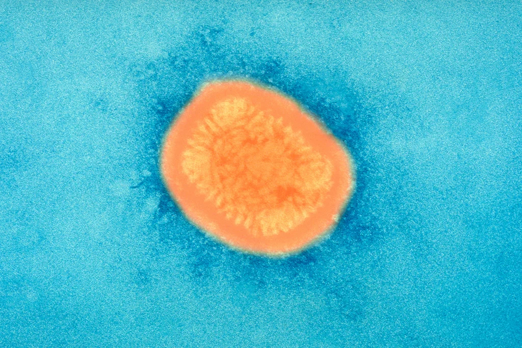 Electron microscope image of smallpox virus (Poxvirus). Used in accordance with Creative Commons . Sourced via Flickr .