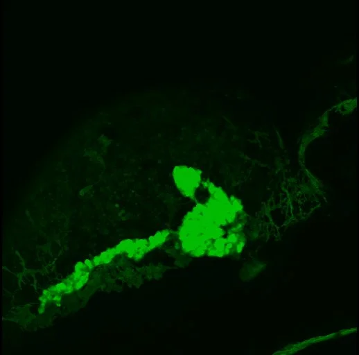Projection of  Indo_Early_5.jpg