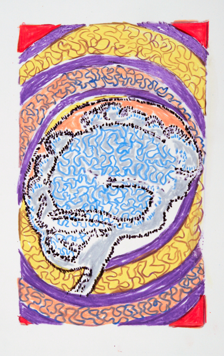 Cerebral