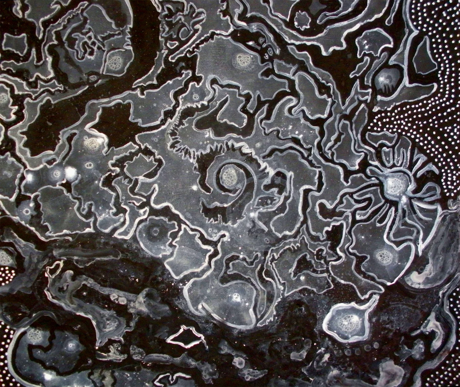 Coming to Terms Series- Osteoporosis