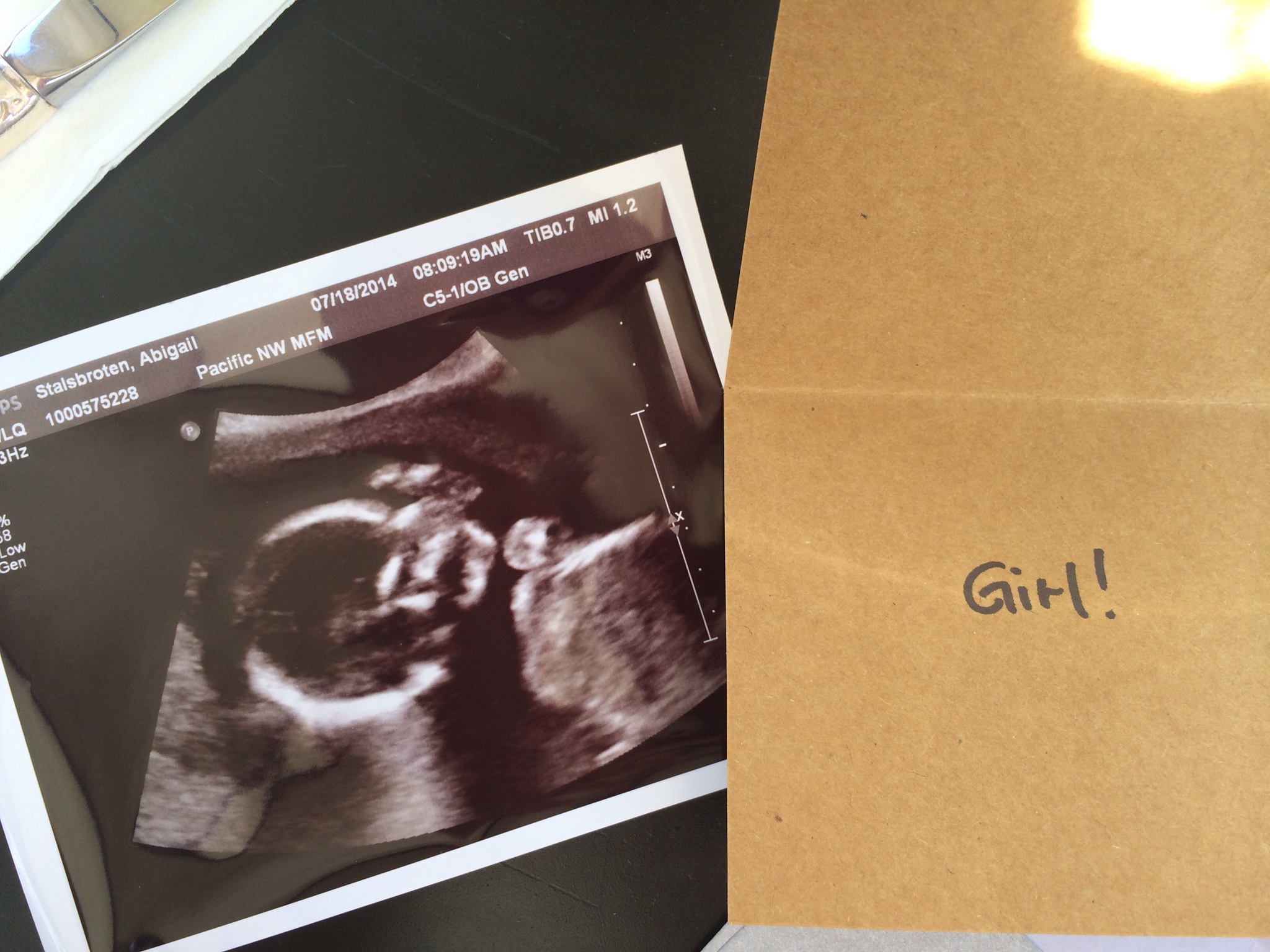 20 week ultrasound!