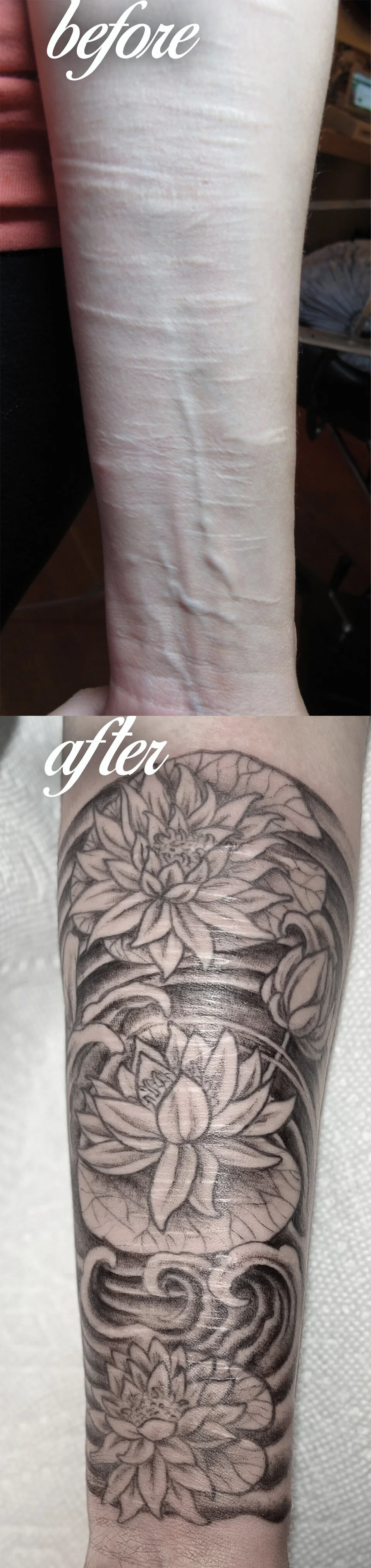 Self Harm Scar Coverups Bella Rose Tattoo