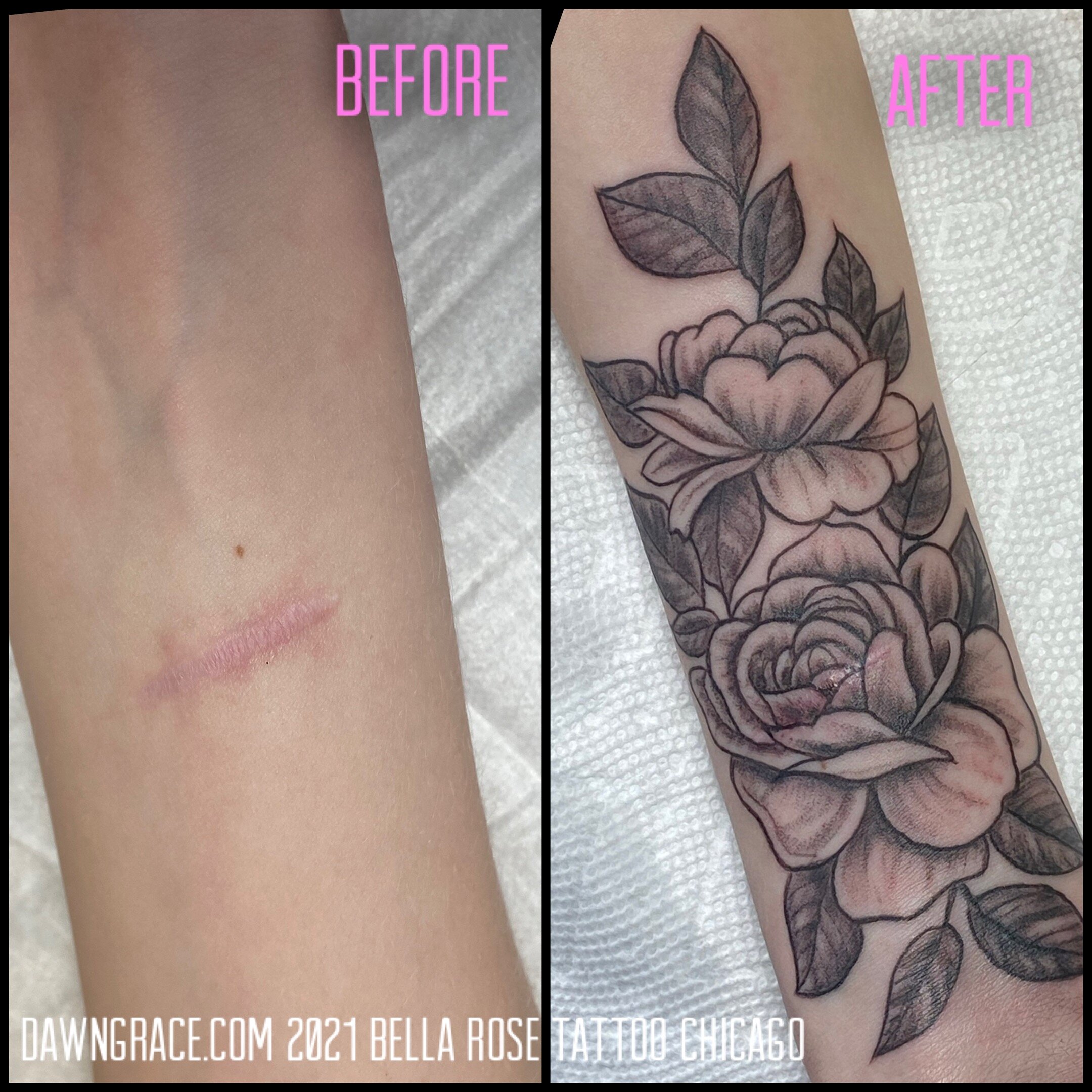 SCAR COVER UP covering a scar with a tattoo heres everything you need to  know  Lady Sara Tattoo