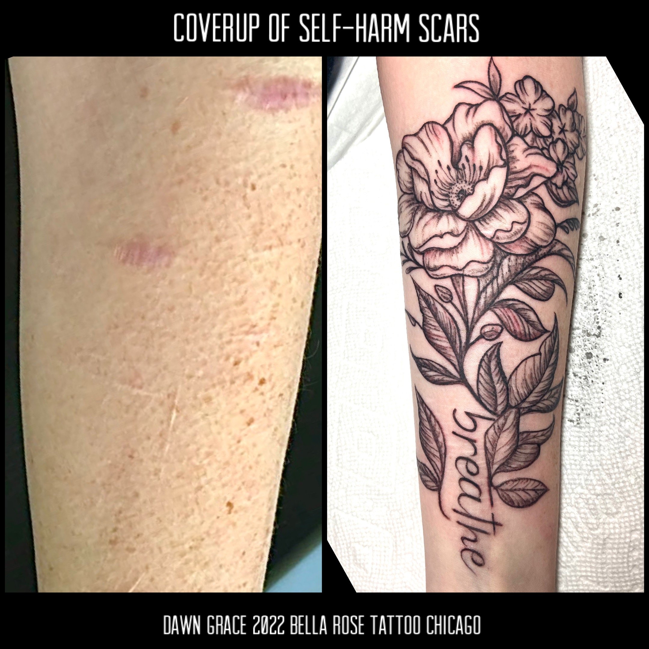 Share more than 69 foot scar tattoo cover up  thtantai2