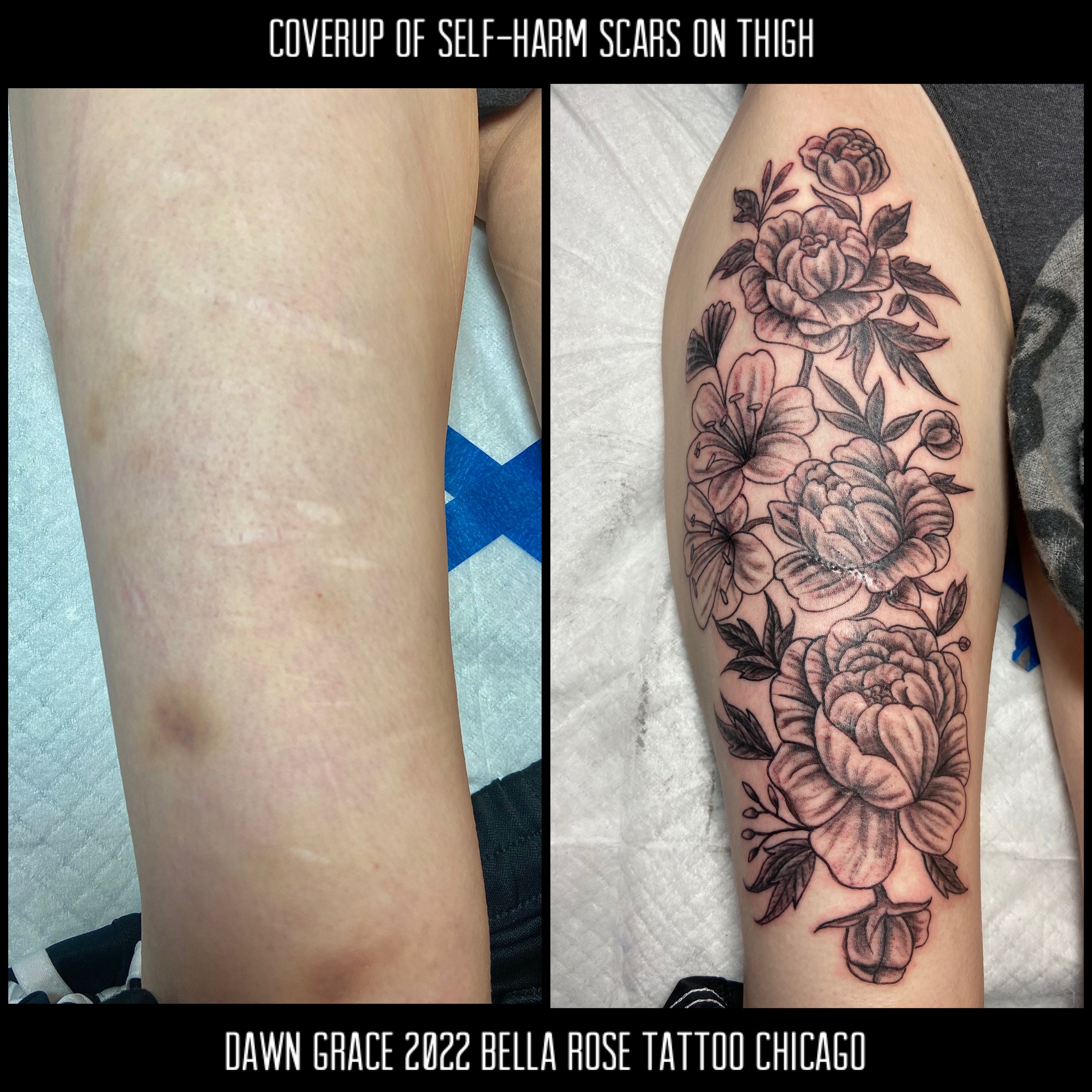 Tattoo ideas for cutting scars