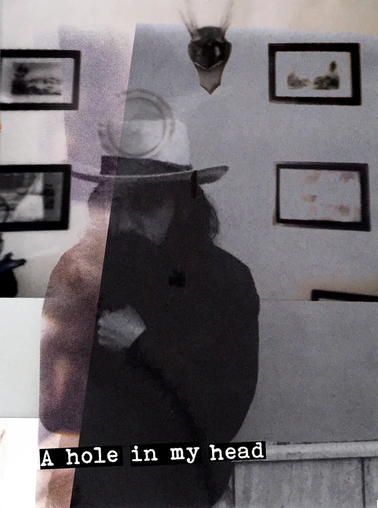 A hole in my head