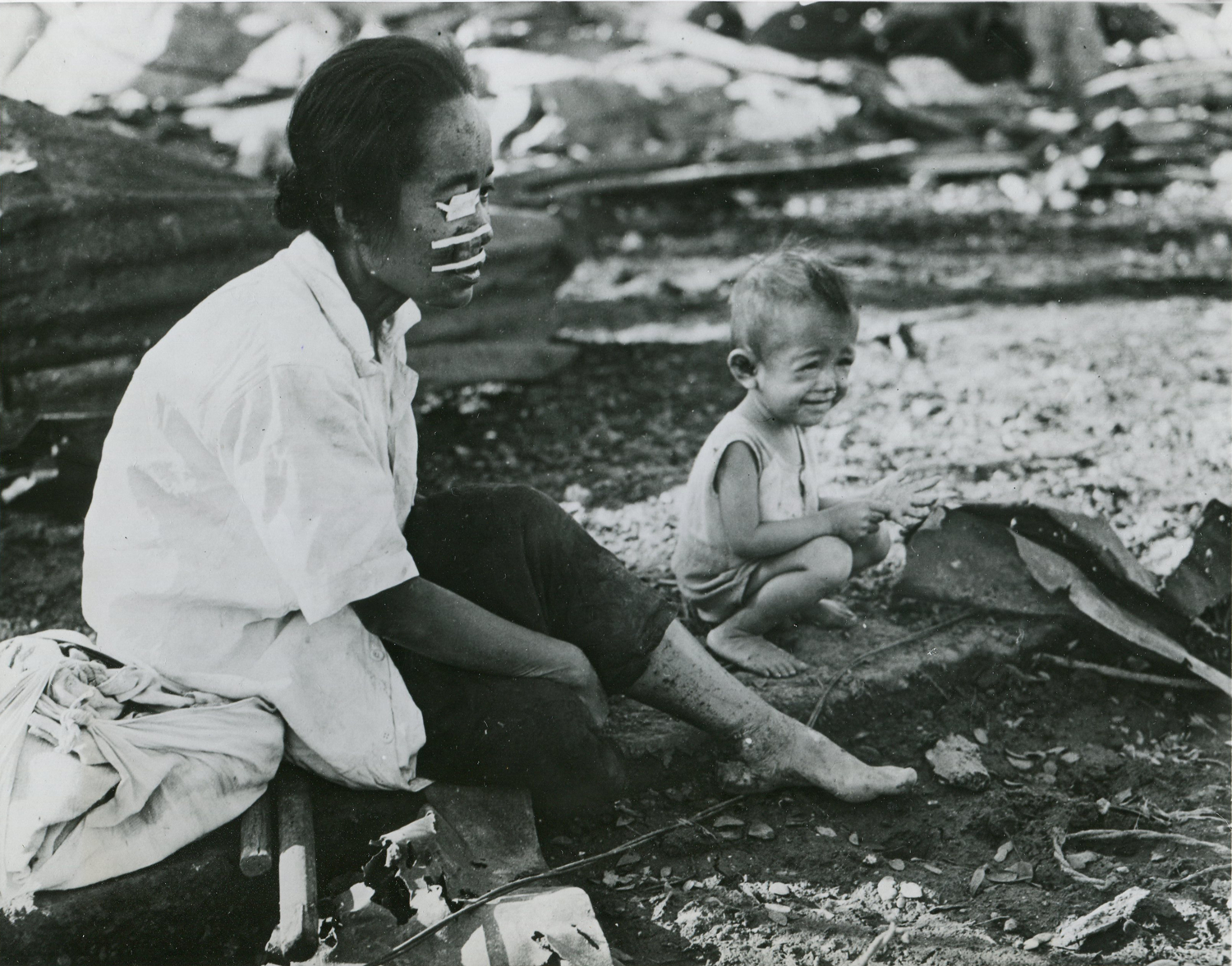 A Filipino woman, wounded in the face and eye by shrapnel, waits with her child in front of the family’s burned home in Paco for help across the Pasig River. (National Archives)