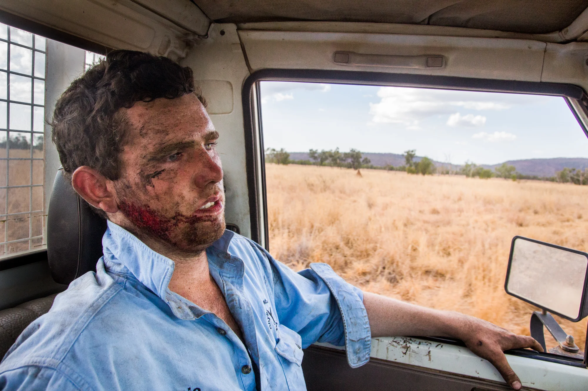 Jamie “Mulga” Mackenzie (19), concussed and on his way to the Kununurra Hospital. After losing control of his horse while on a cattle drive he was knocked off by a tree branch. He returned to work two days later.