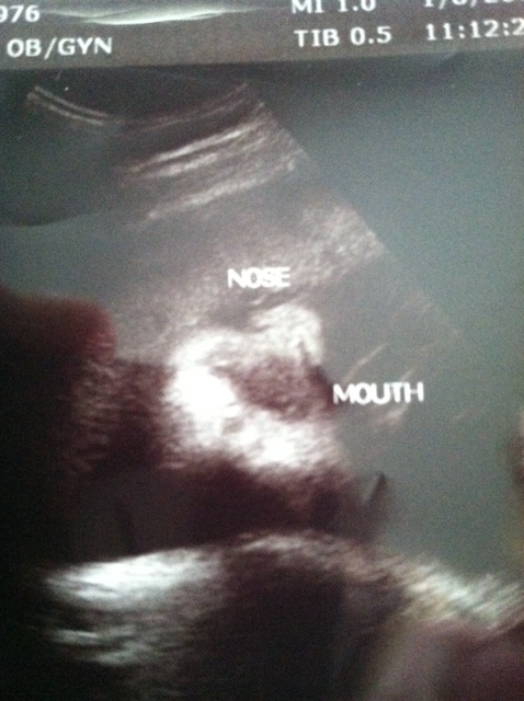 Nose_mouth.jpg