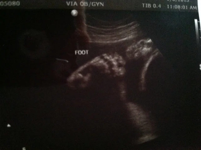 Ultrasound_foot.jpg