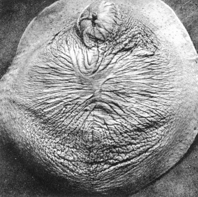 The “Greater Seal” castration, meaning both penis and testicles.