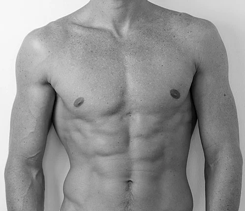 La chirurgie esthétique permet d’obtenir un torse sculpté avec des abdominaux visibles