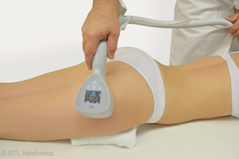 L’Exilis Elite™, appareil anti-cellulite qui associe radiofréquence monopolaire et ultrasons